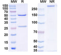 SDS-PAGE for Anti-Human S100B Monoclonal Antibody (1A102)
