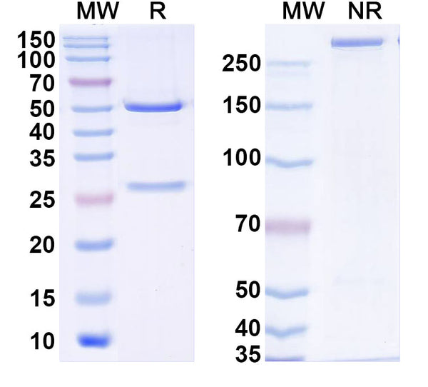 SDS-PAGE for Anti-Human S100B Monoclonal Antibody (1A102)