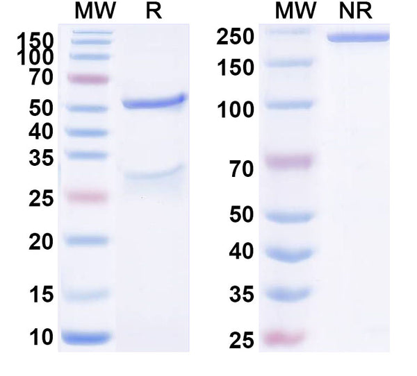 SDS-PAGE for Anti-Human S100B Monoclonal Antibody (1A103)