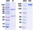 SDS-PAGE for Anti-Human S100B Monoclonal Antibody (1A295)