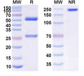 Anti-Human CD20 Reference Antibody (Tositumomab) – Figure 1 of 1