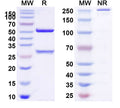 Anti-Human CD20 Reference Antibody (Veltuzumab) – Figure 1 of 1