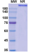 Anti-Human CD20 Reference Antibody (Ocaratuzumab) – Figure 1 of 1