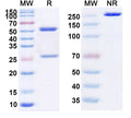 Anti-Human CD20 Reference Antibody (Zuberitamab) – Figure 1 of 1