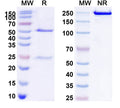 Anti-Human CD20/MS4A1 Reference Antibody (MT-3724) – Figure 1 of 1