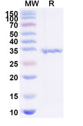Recombinant Human FN1 Protein, N-His