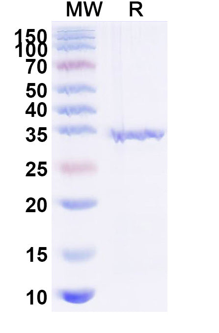 Recombinant Human FN1 Protein, N-His