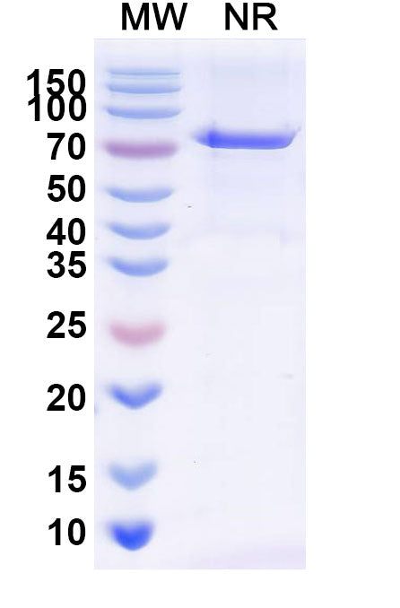 Anti-Human EDB Reference Antibody (Radretumab) – Figure 1 of 1