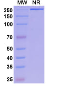 Anti-Human PDGF R beta Reference Antibody (Rinucumab) – Figure 1 of 1