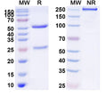 Anti-Human CD140b/PDGFRB Reference Antibody (IMC-2C5) – Figure 1 of 1