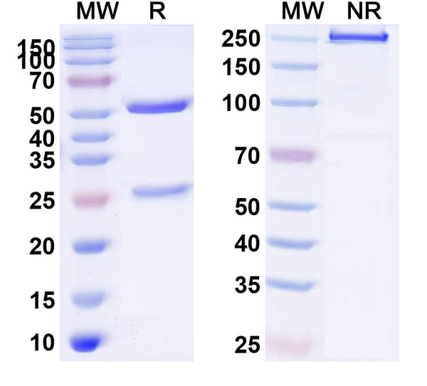 Anti-Human CD140b/PDGFRB Reference Antibody (IMC-2C5) – Figure 1 of 1