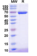 Recombinant Human AFP/Alpha-fetoprotein Protein, C-His