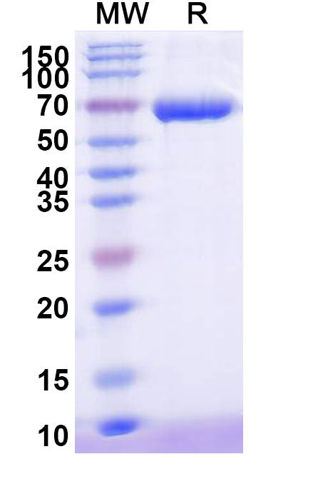 Recombinant Human AFP/Alpha-fetoprotein Protein, C-His