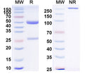 SEC-HPLC detection for Anti-Human AFP/Alpha-fetoprotein Antibody (AF5).