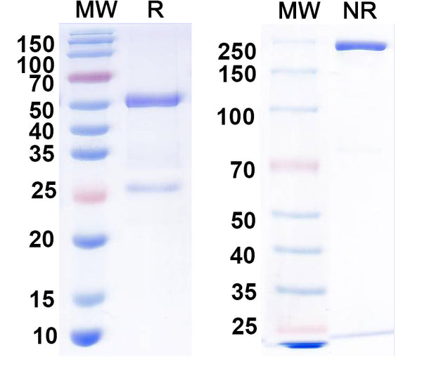 SDS-PAGE for Anti-Human AFP/Alpha-fetoprotein Monoclonal Antibody (1A263)