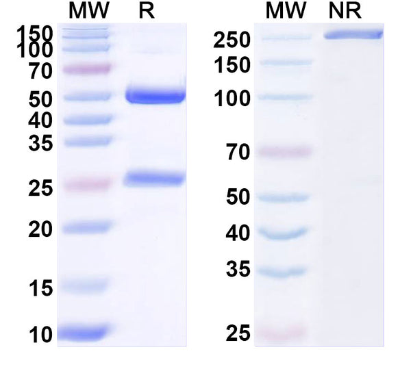SDS-PAGE for Anti-Human AFP/Alpha-fetoprotein Monoclonal Antibody (1A265)