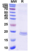 SDS-PAGE for Anti-Human CCL2/MCP-1 Nanobody (SAA1269).