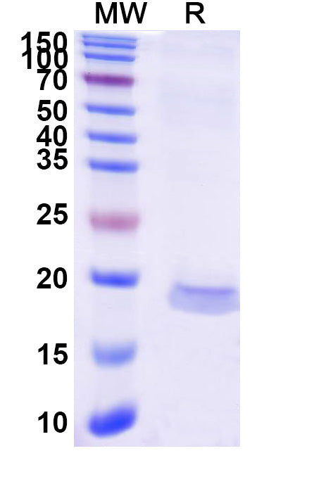 SDS-PAGE for Anti-Human CCL2/MCP-1 Nanobody (SAA1269).