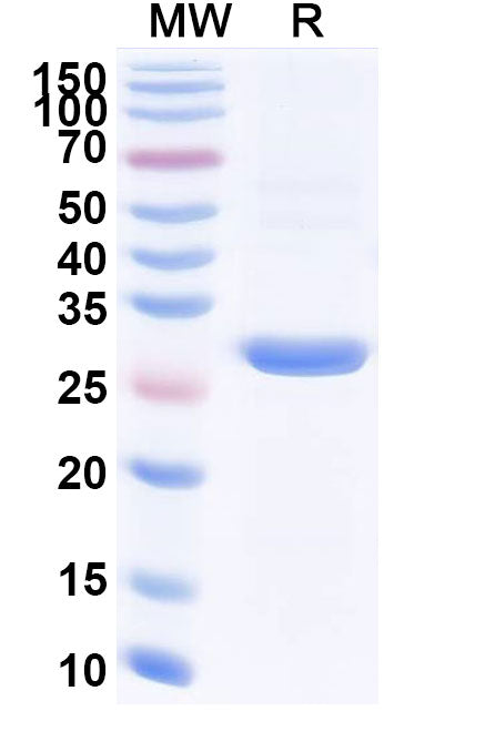 SDS-PAGE for Anti-CD340/ERBB2/HER2 scFV Antibody (SAA2245).