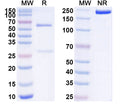 SDS-PAGE for Anti-Human APOB Antibody (SAA1553)