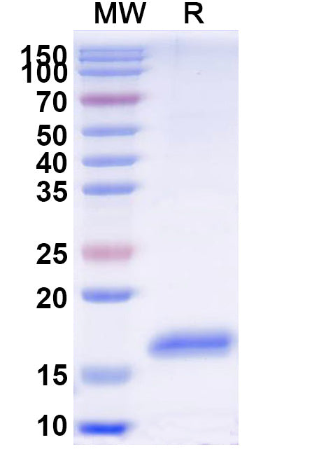 SDS-PAGE for Anti-Human GBA Nanobody (SAA2277)