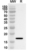 Western blot analysis was performed using anti-CD7 polyclonal antibody at 1ug/mL on recombinant CD7 (Catalog No. HY302012).