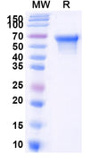 Recombinant Human CD55 Protein, C-His