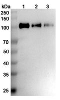 SEC-HPLC detection for Anti-Human CD56/NCAM1 Antibody (ABS0338).