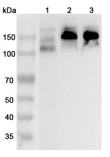 Western blot analysis was performed using anti-NCAM1 polyclonal antibody at 1μg/ml on various samples.
Lane 1: Mouse cerebellum lysate
Lane 2: Rat brain lysate
Lane 3: Rat cerebellum lysate