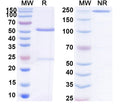 SDS-PAGE for Anti-Human CD56/NCAM1 Antibody (SAA2213)