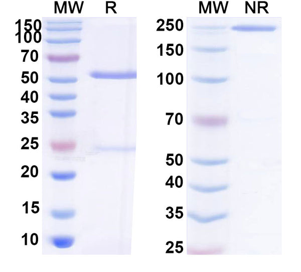 SDS-PAGE for Anti-Human CD56/NCAM1 Antibody (SAA2213)