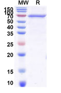 Recombinant Human AR/Androgen receptor Protein, N-His