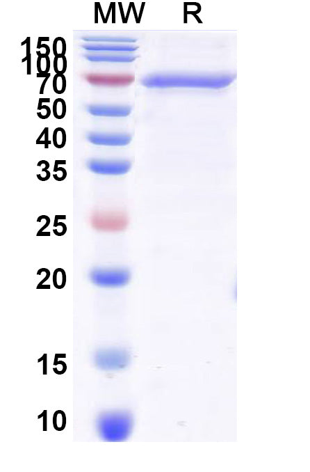 Recombinant Human AR/Androgen receptor Protein, N-His