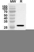 Western blot analysis was performed using anti-CD61/ITGB3 polyclonal antibody at 1ug/mL on recombinant CD61/ITGB3 (Catalog No. HY323012).