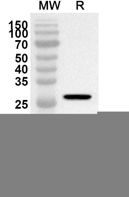 Western blot analysis was performed using anti-CD61/ITGB3 polyclonal antibody at 1ug/mL on recombinant CD61/ITGB3 (Catalog No. HY323012).