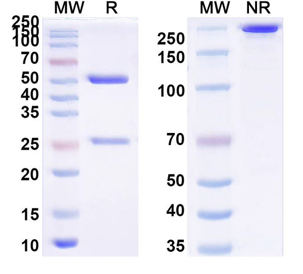 SDS-PAGE for Anti-K48-linked Polyubiquitin Antibody (SAA0329).