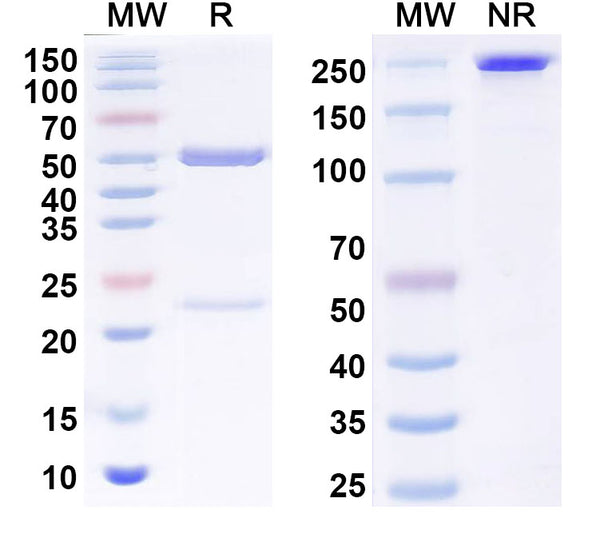 SDS-PAGE for Anti-K63-linked Polyubiquitin Antibody (SAA0330).