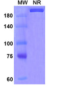 Anti-Human IL-6 Reference Antibody (Ziltivekimab) – Figure 1 of 1