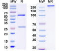 SEC-HPLC detection for Anti-Human IL6 Antibody (ABS1221).