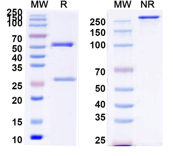 SEC-HPLC detection for Anti-Human IL6 Antibody (ABS1221).