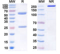 Anti-Human IL-6 Reference Antibody (Elsilimomab) – Figure 1 of 1