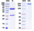 SDS-PAGE for Anti-Human hCG Antibody (E12#)