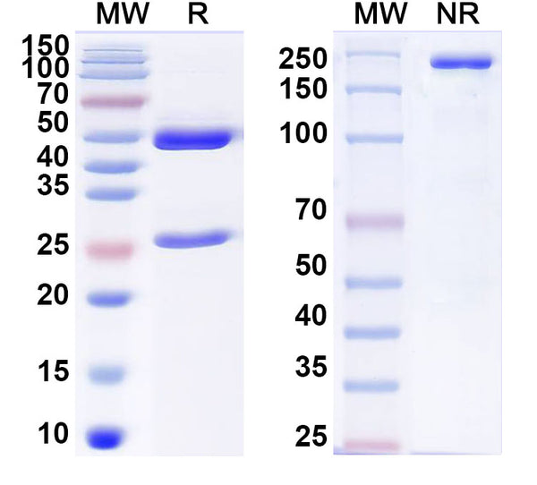 SDS-PAGE for Anti-Human hCG Antibody (E12#)