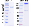 SDS-PAGE for Anti-Human HCG Monoclonal Antibody (1A369)