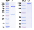 SDS-PAGE for Anti-Human HCG Monoclonal Antibody (1A370)