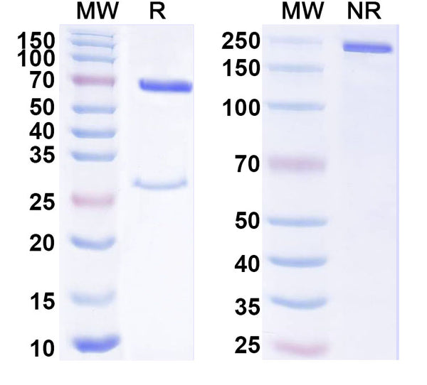 SDS-PAGE for Anti-Human HCG Monoclonal Antibody (1A370)