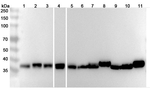 Western blot analysis was performed using anti-ALDOA polyclonal antibody at 1μg/ml on various samples.
Lane 1: Hela cell lysate
Lane 2: A549 cell lysate
Lane 3: HepG2 cell lysate
Lane 4: MCF7 cell lysate
Lane 5: 293T cell lysate
Lane 6: Mouse liver lysate
Lane 7: Mouse kidney lysate
Lane 8: Mouse brain lysate
Lane 9: Rat liver lysate
Lane 10: Rat kidney lysate
Lane11: Rat brain lysate