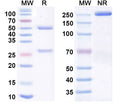 Anti-Human Complement Component C1q Reference Antibody (Tanruprubart) – Figure 1 of 1
