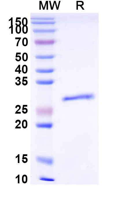 Recombinant Human ESR1/ER-alpha Protein, N-His