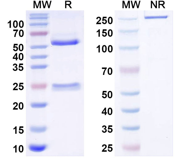SDS-PAGE for Anti-Human ESR1/ER-alpha Antibody (RB133)